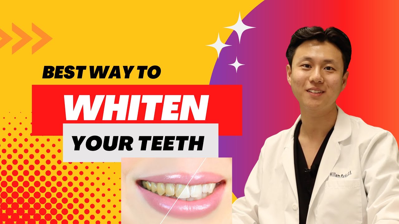 Best Teeth Whitening Method? | DENTIST ANSWERS - YouTube